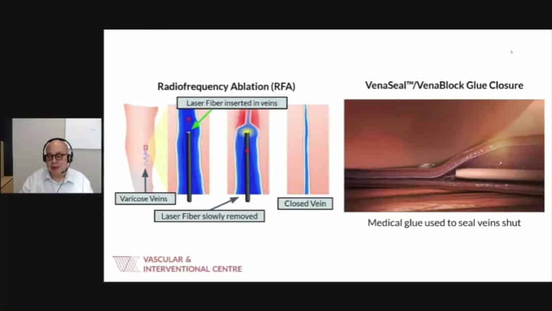 Addressing Chronic Pelvic Pain: Legs and Pelvic Vascular Pain by Dr Benjamin Chua