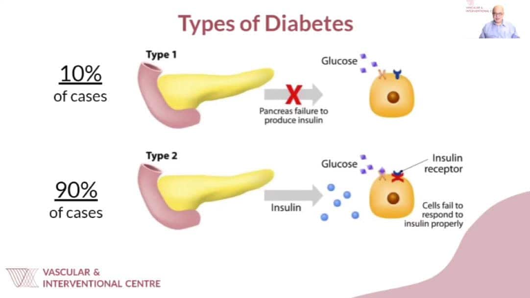 Types of Diabetes